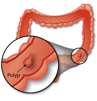 Bệnh viêm da cơ địa có lây không và một số vấn đề cần lưu ý