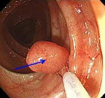 Bệnh viêm da cơ địa có lây không và một số vấn đề cần lưu ý