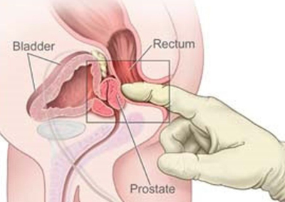 Bệnh viêm da cơ địa có lây không và một số vấn đề cần lưu ý