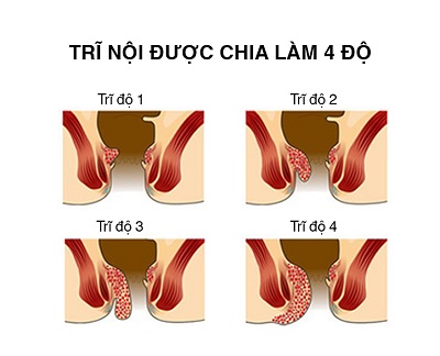 Bệnh viêm da cơ địa có lây không và một số vấn đề cần lưu ý