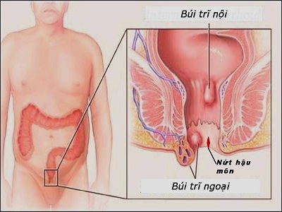 Bệnh viêm da cơ địa có lây không và một số vấn đề cần lưu ý