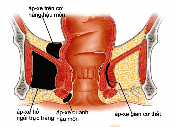 Bệnh viêm da cơ địa có lây không và một số vấn đề cần lưu ý